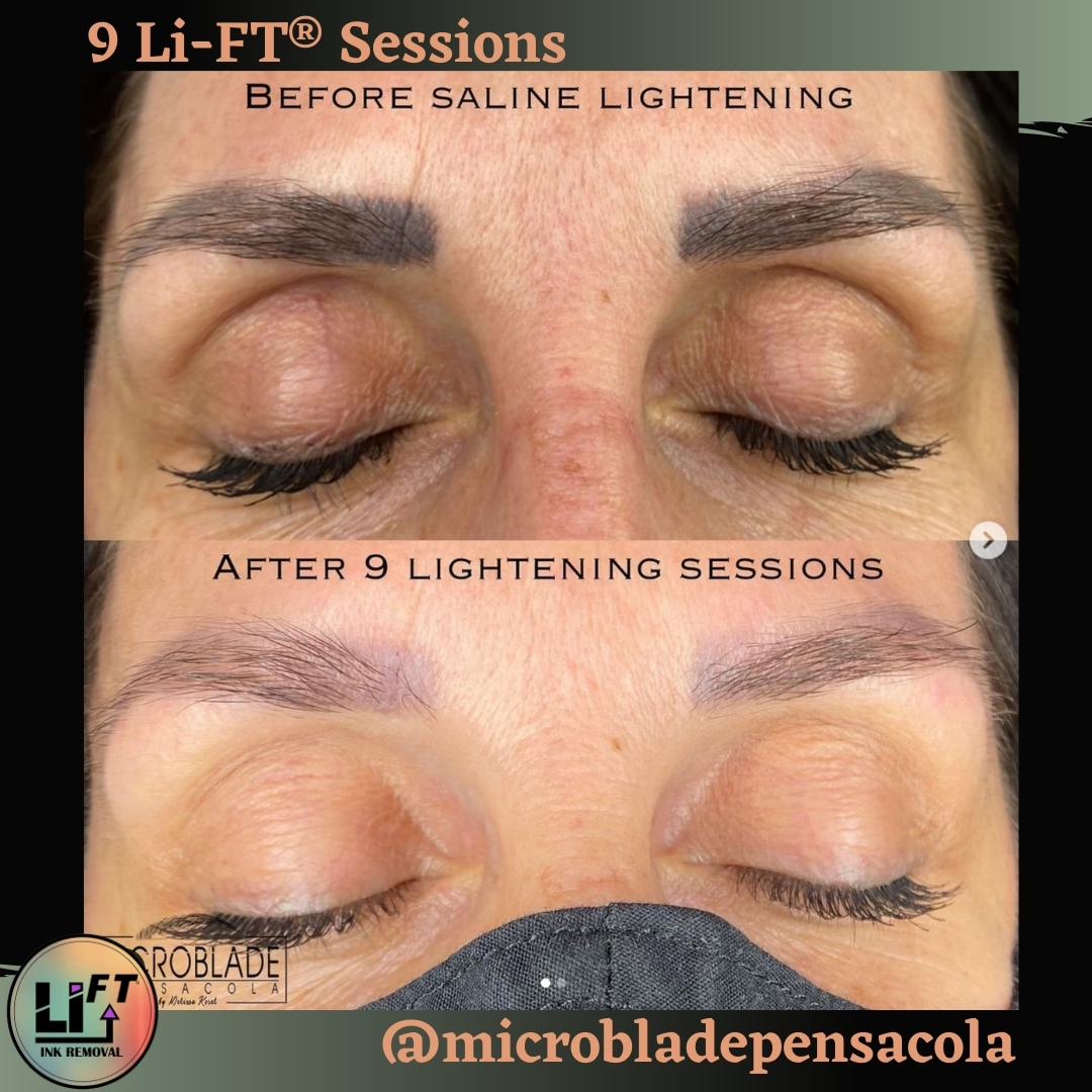Li PIGMENTS Philippines  LIFT Saline Removal is one of the best safest  and most effective Permanent Makeup and Tattoo Lightening removal system  for Microblading eyebrows lip liners and body tattoos It